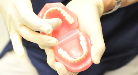 歯の模型の画像